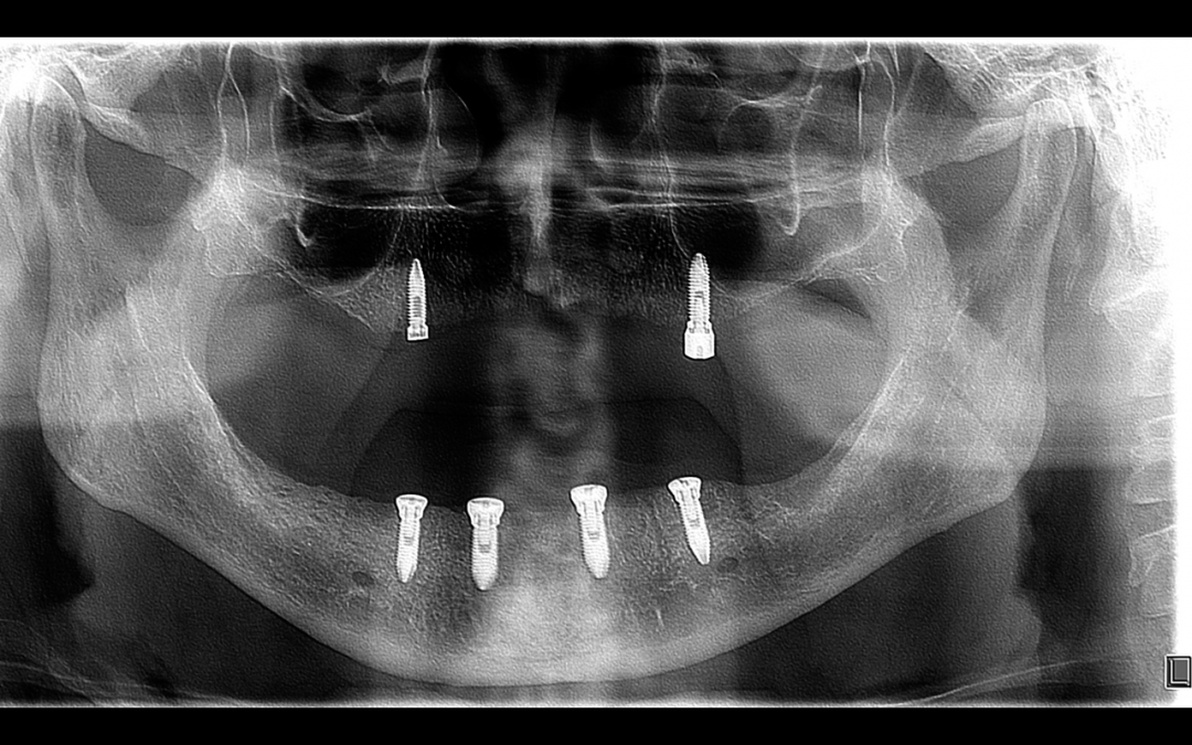 Imagenología radiográfica